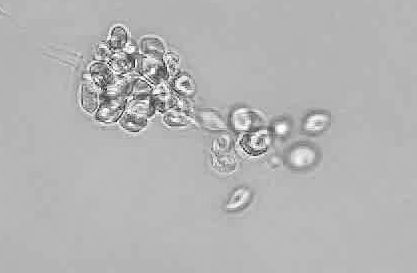 P. dissotocum_GK17Ren5sh_NB280082-frame-at-1m6s3-1